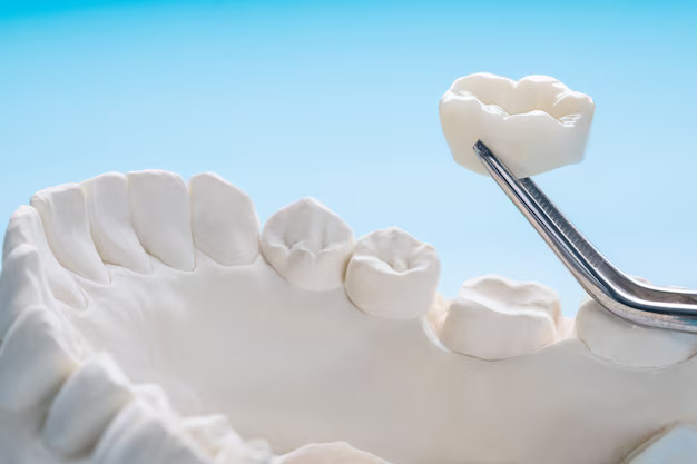 Best dentist for crowns