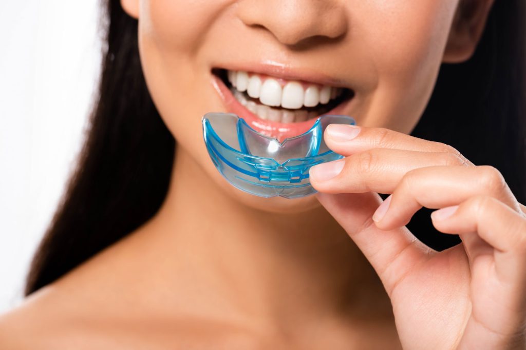 mouthguard in Cheshire