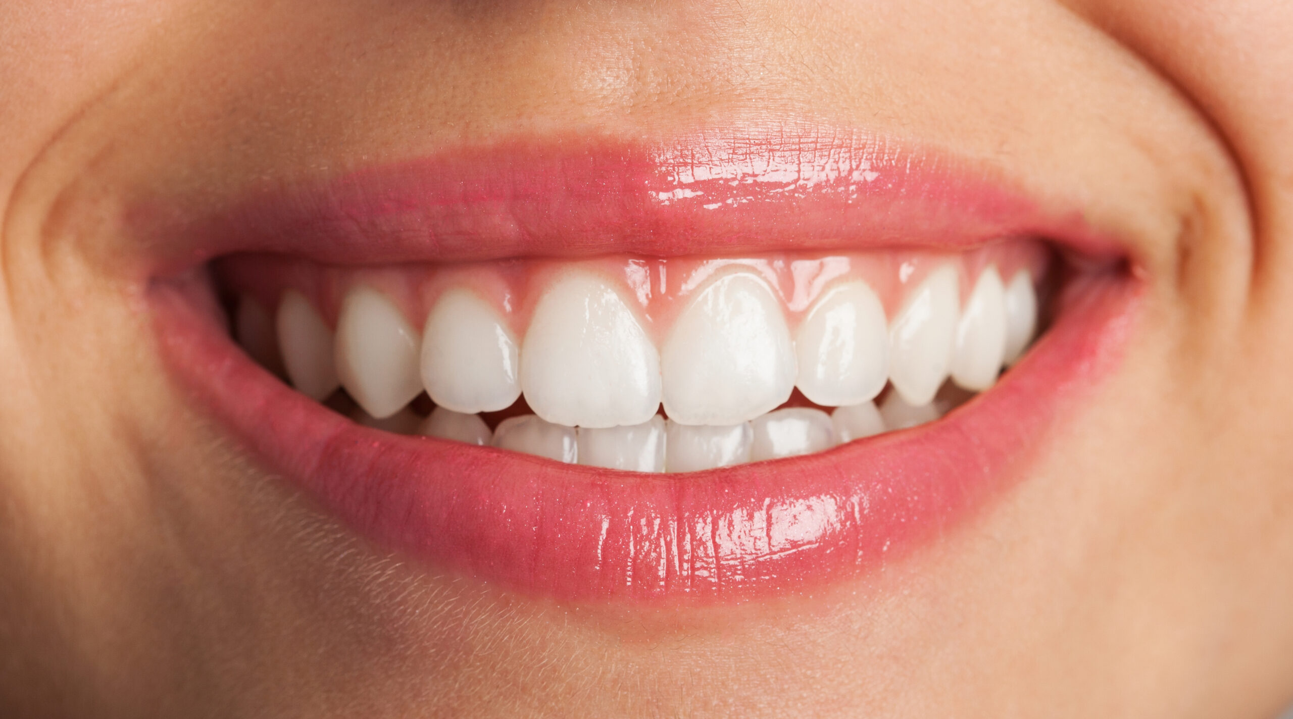 Teeth whitening for sensitive teeth