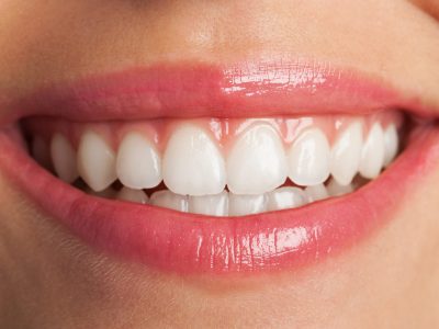 perfect smile with red lips, extreme closeup perfect smile with red lips, extreme closeup